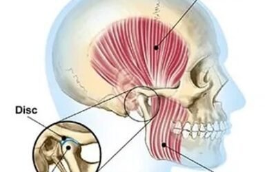 Is Your Jaw Giving You a Headache?