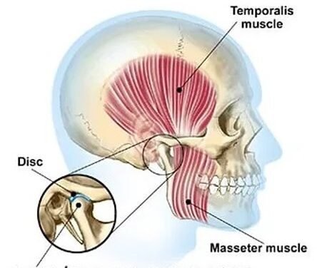 Is Your Jaw Giving You a Headache?